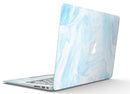 Blue_191_Textured_Marble_-_13_MacBook_Air_-_V4.jpg