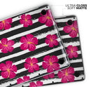 Tropical Summer Hot Pink Floral v2 - Skin Decal Wrap Kit Compatible with the Apple MacBook Pro, Pro with Touch Bar or Air (11", 12", 13", 15" & 16" - All Versions Available)